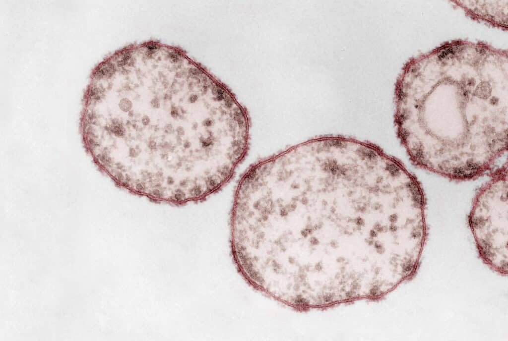 measles virus 1