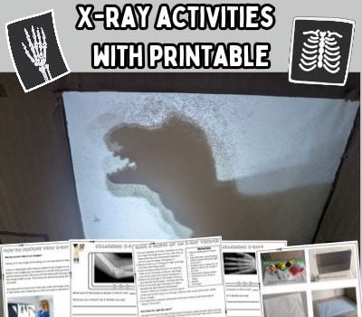 X-Ray Activities for Kids