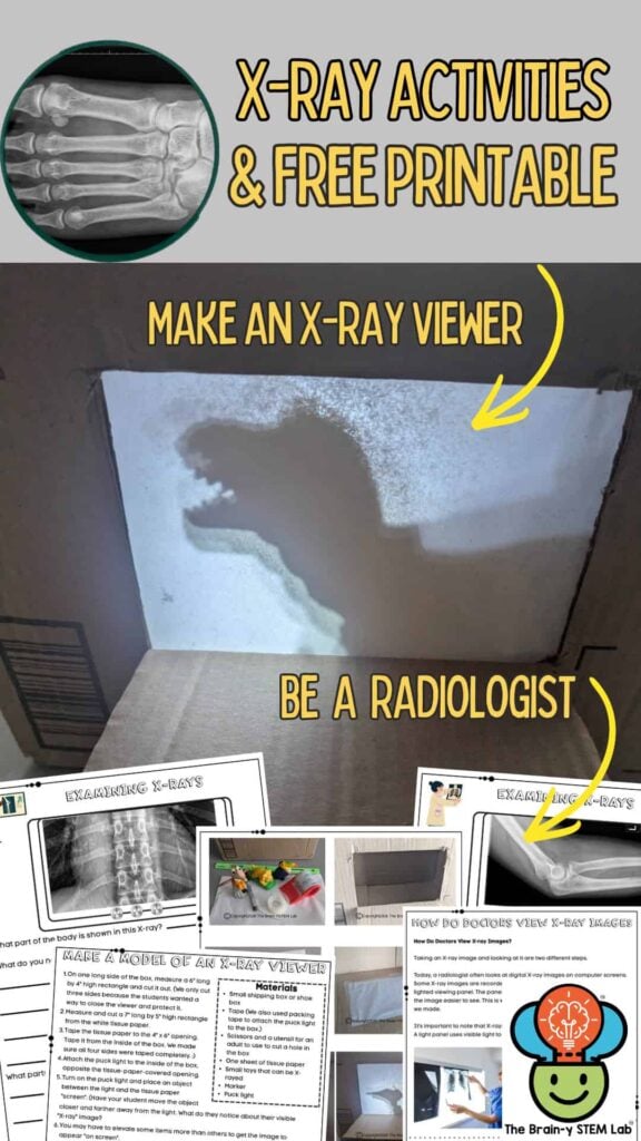 X-ray activities for kids