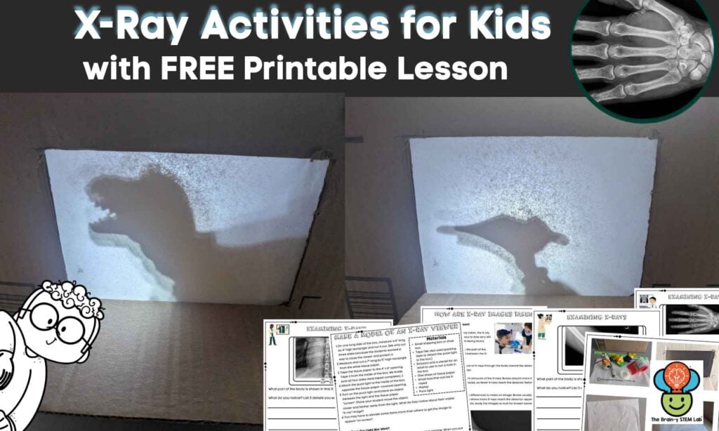 X-ray activities for kids